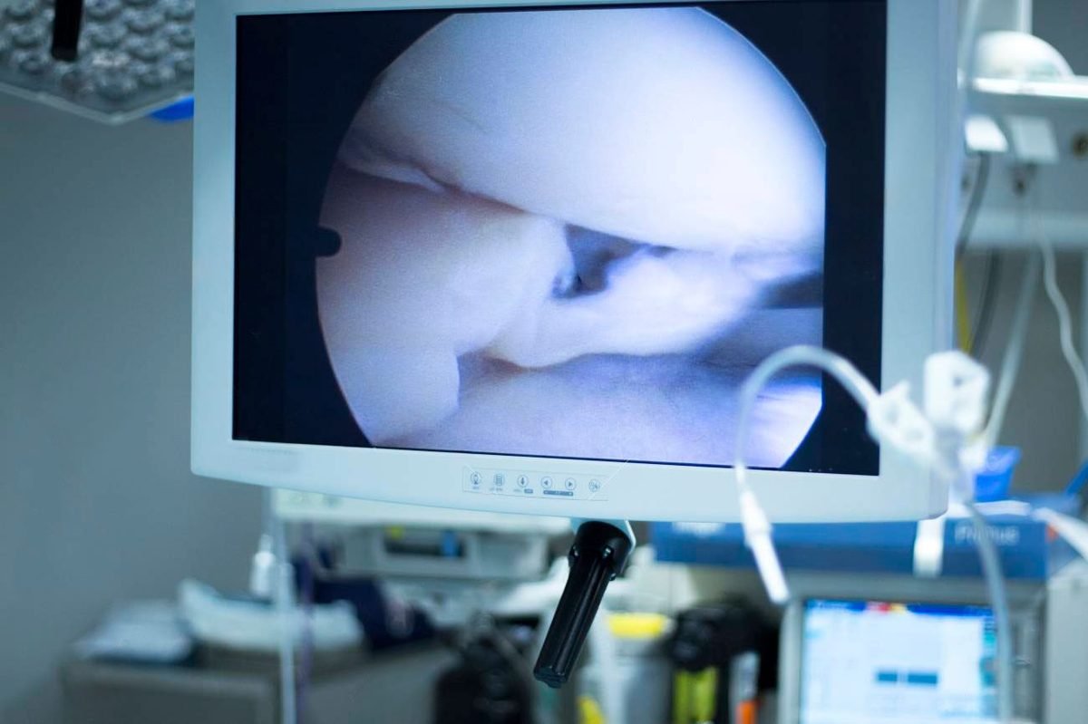 Histerosalpingografía